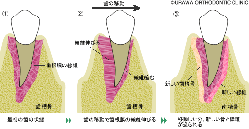 歯の移動の仕組み図