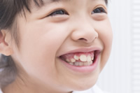 子どものデコボコの歯並び
