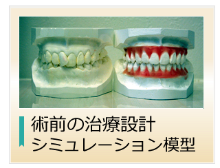 予知的な治療設計 シミュレーション模型